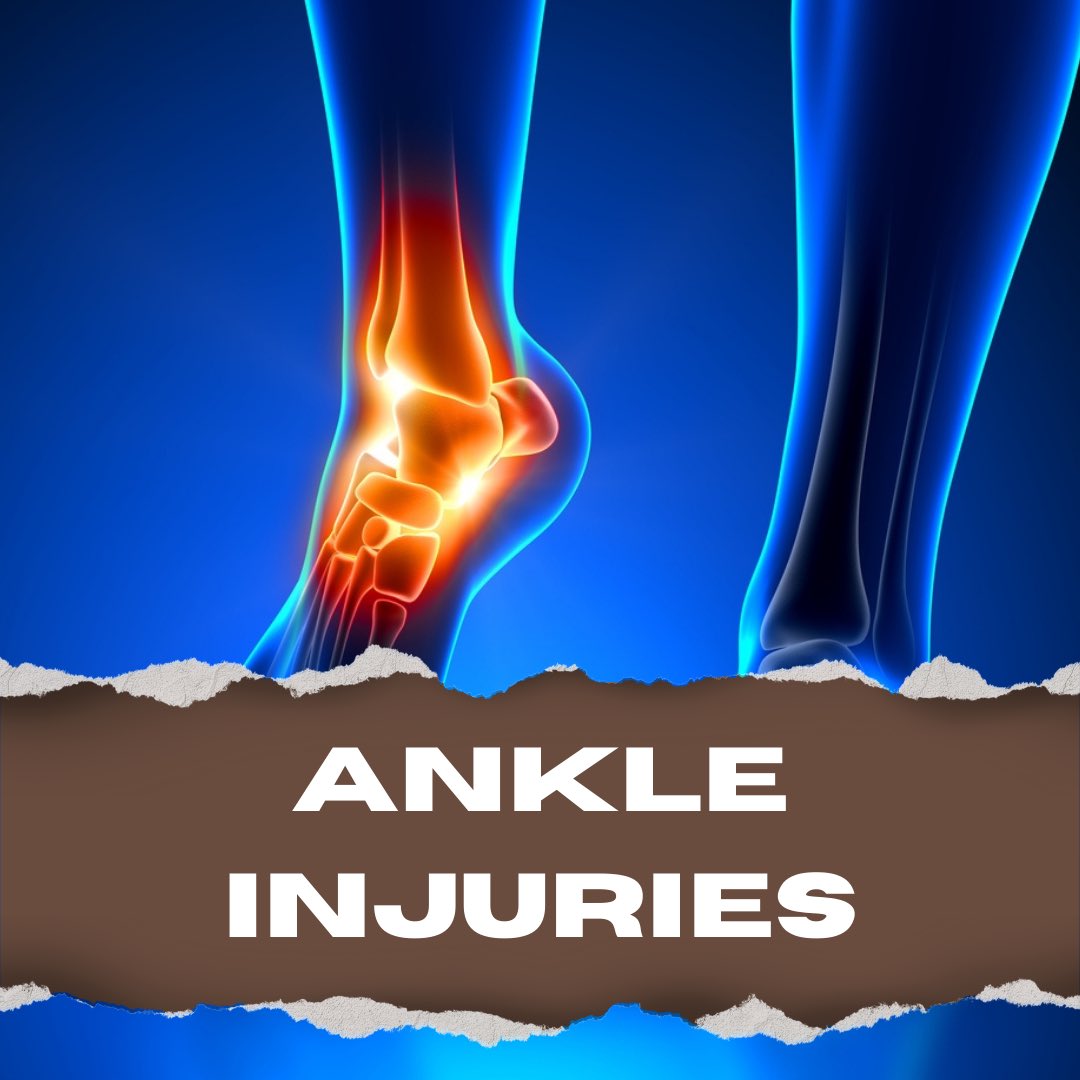 SportsMedCN's tweet photo. A look into common ankle injuries in athletics: #athletictraining #NATM2023 #TheresAnATForThat #TNATA #WeAreD9 #IAmD9 https://t.co/fF7INz3tlQ
