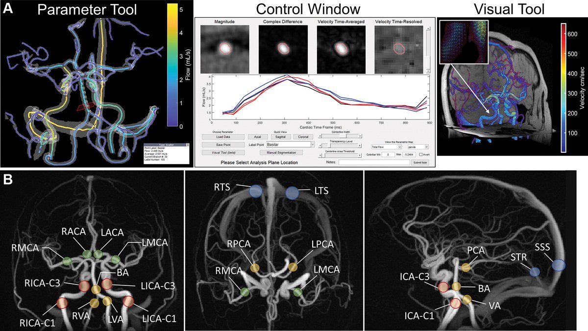 Seoul National University Hospital on Twitter "RT radiology_rsna Are