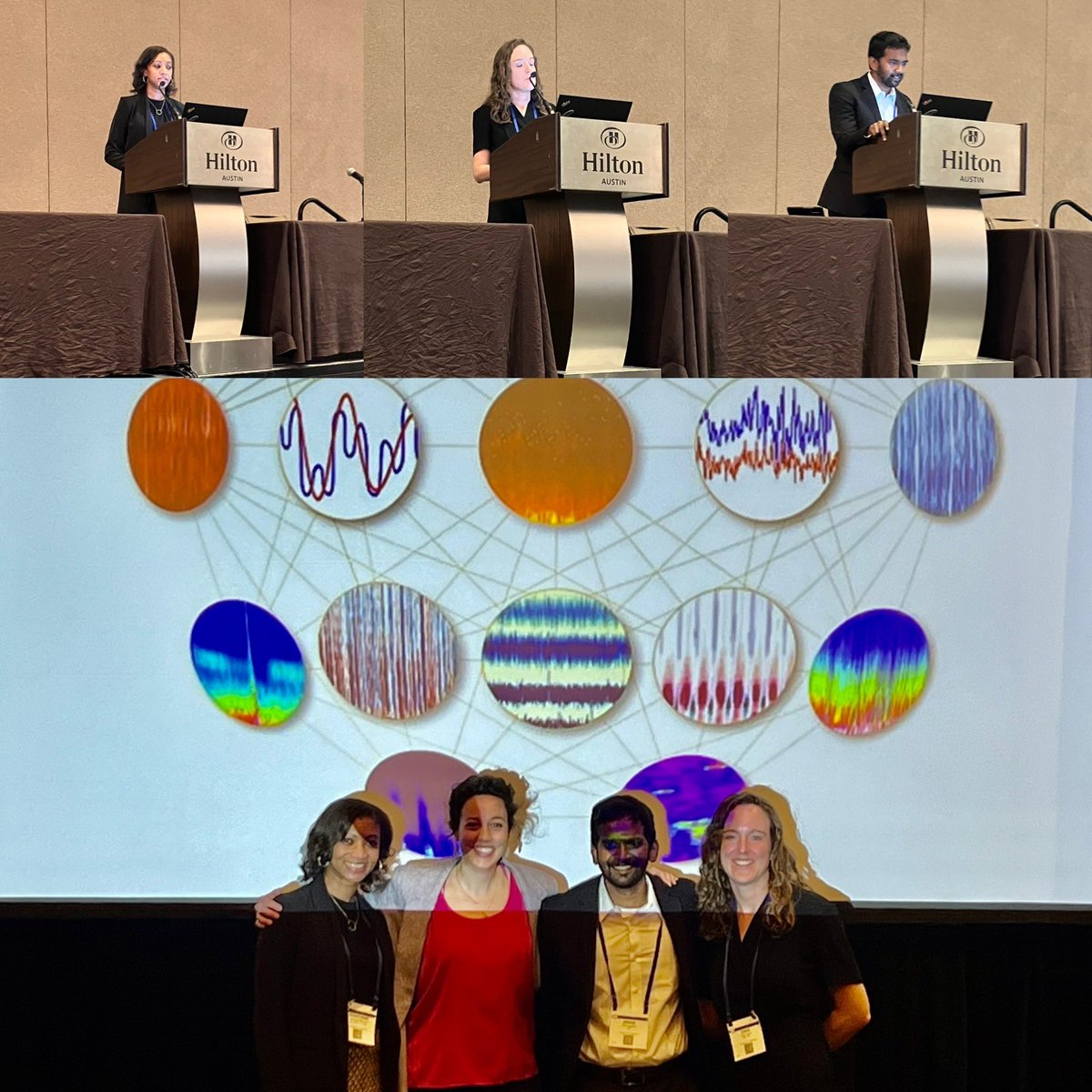 Giulia Benedetti (@giuliabene16) on Twitter photo <a href="/ACNS_org/">ACNS</a> 2023: qEEG in PCCM all star panel. Such a joy to learn from these leaders in the field, from qEEG use in neonates, detecting neuro emergencies in PCCM, to qEEG in coma/disorders of consciousness. <a href="/PedQuEST_EEG/">PedQuEST</a> <a href="/DanaHarrar/">Dana Harrar</a> <a href="/AppavuBrian/">Brian Appavu, MD</a>, Shavonne Massey 🌈🧠⚡️👏 <a href="/ACNS_org/">ACNS</a> 2023: qEEG in PCCM all star panel. Such a joy to learn from these leaders in the field, from qEEG use in neonates, detecting neuro emergencies in PCCM, to qEEG in coma/disorders of consciousness. <a href="/PedQuEST_EEG/">PedQuEST</a> <a href="/DanaHarrar/">Dana Harrar</a> <a href="/AppavuBrian/">Brian Appavu, MD</a>, Shavonne Massey 🌈🧠⚡️👏