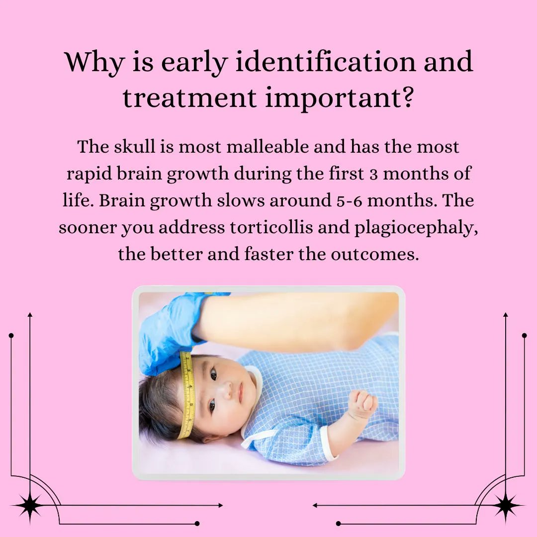 Playworks_Chi's tweet photo. Why is early identification and treatment important: 
The skull is most malleable &amp; has the most rapid brain growth during the first 3 months of life. Brain growth slows at 5-6 months. The sooner you address torticollis &amp; plagiocephaly, the better and faster the outcomes. https://t.co/OU18gz6ef7