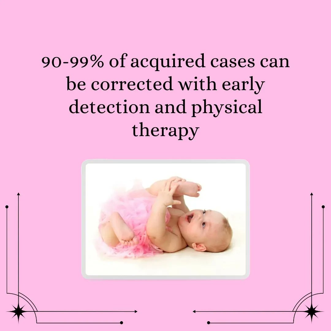 Playworks_Chi's tweet photo. Why is early identification and treatment important: 
The skull is most malleable &amp; has the most rapid brain growth during the first 3 months of life. Brain growth slows at 5-6 months. The sooner you address torticollis &amp; plagiocephaly, the better and faster the outcomes. https://t.co/OU18gz6ef7