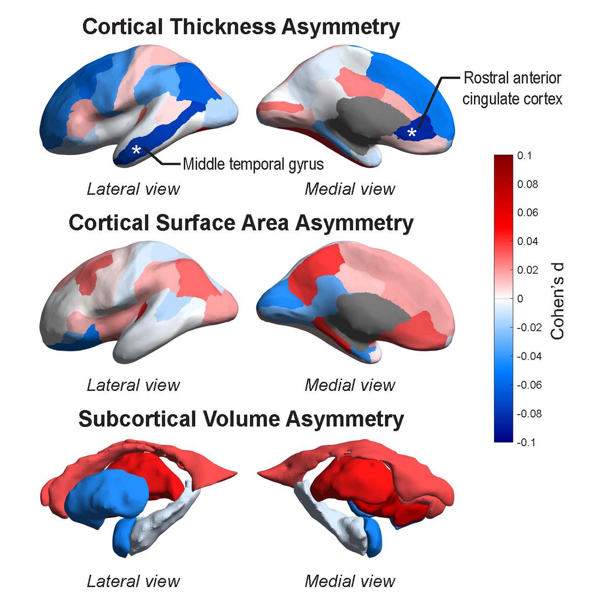 ClydeFrancks's tweet photo. Our @enigmabrains consortium study of brain asymmetry in #schizophrenia is out in @PNASnews https://t.co/wH451Z4ejo We worked with brain image data from 5,080 affected and 6,015 unaffected people - 46 datasets from many countries – the largest sample so far! Summary thread⬇️ https://t.co/rEJO9fhAhp