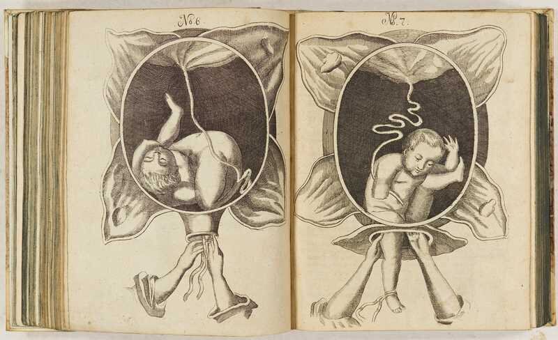 En 1690 Justine Siegemund escribió un libro de obstetricia con el que ayudó a entender el embarazo, al niño por nacer y ayudó a más de 6mil bebés a nacer 

Parece que negar la realidad del embarazo con argumentos proaborto es lo retrógrada