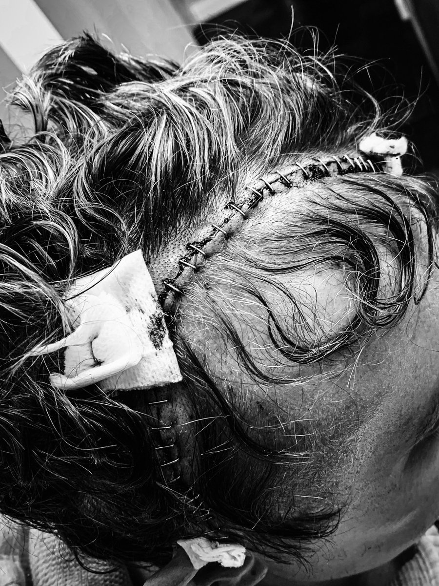 MrLukeJohnston's tweet image. On 8th February 2023, I was diagnosed with an incurable brain tumour.

Here’s what’s happened since, and what’s going to happen soon.

marchtothearch.co.uk

#MarchToTheArch