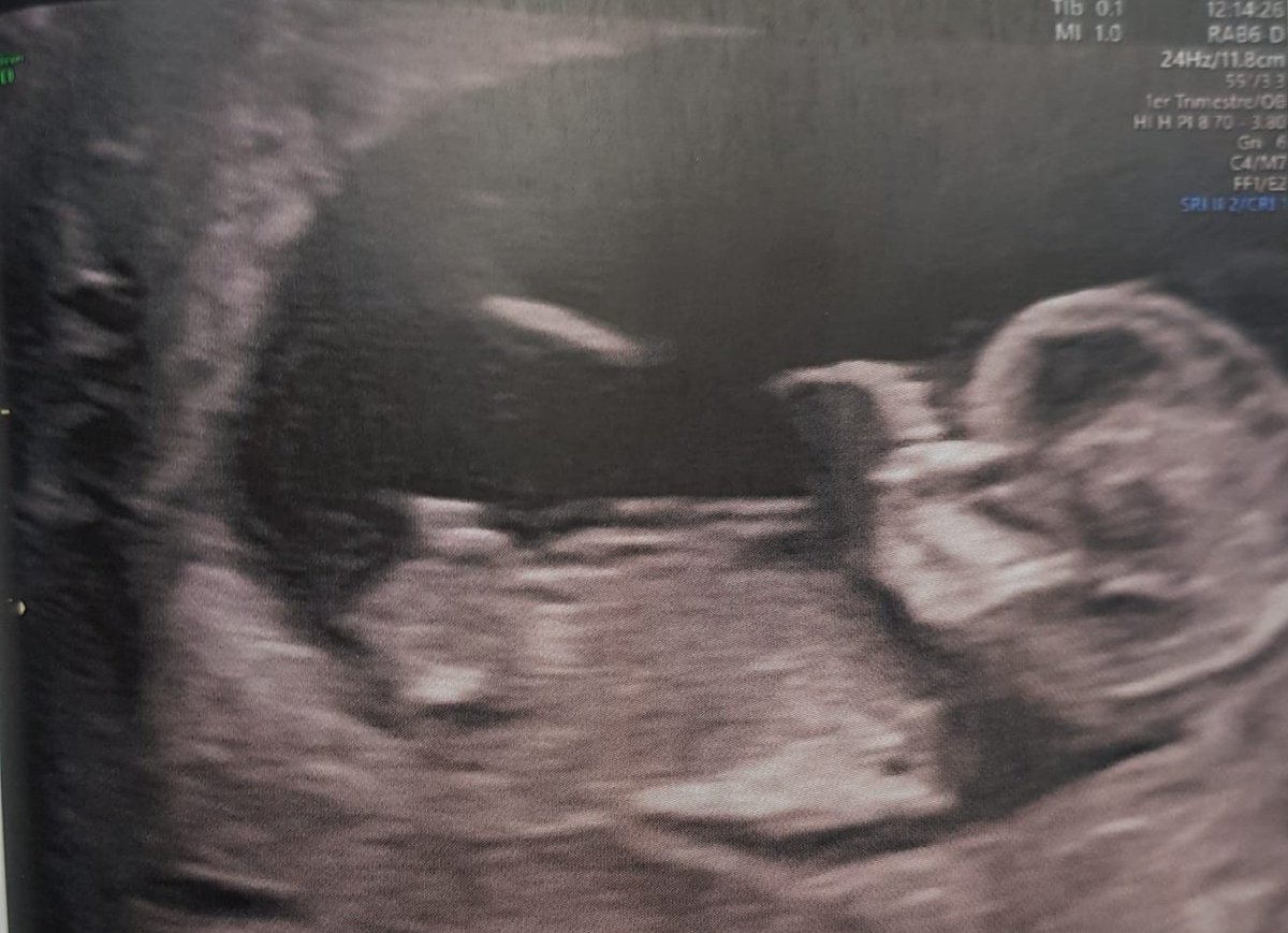 Thomas Alarcon tweet media