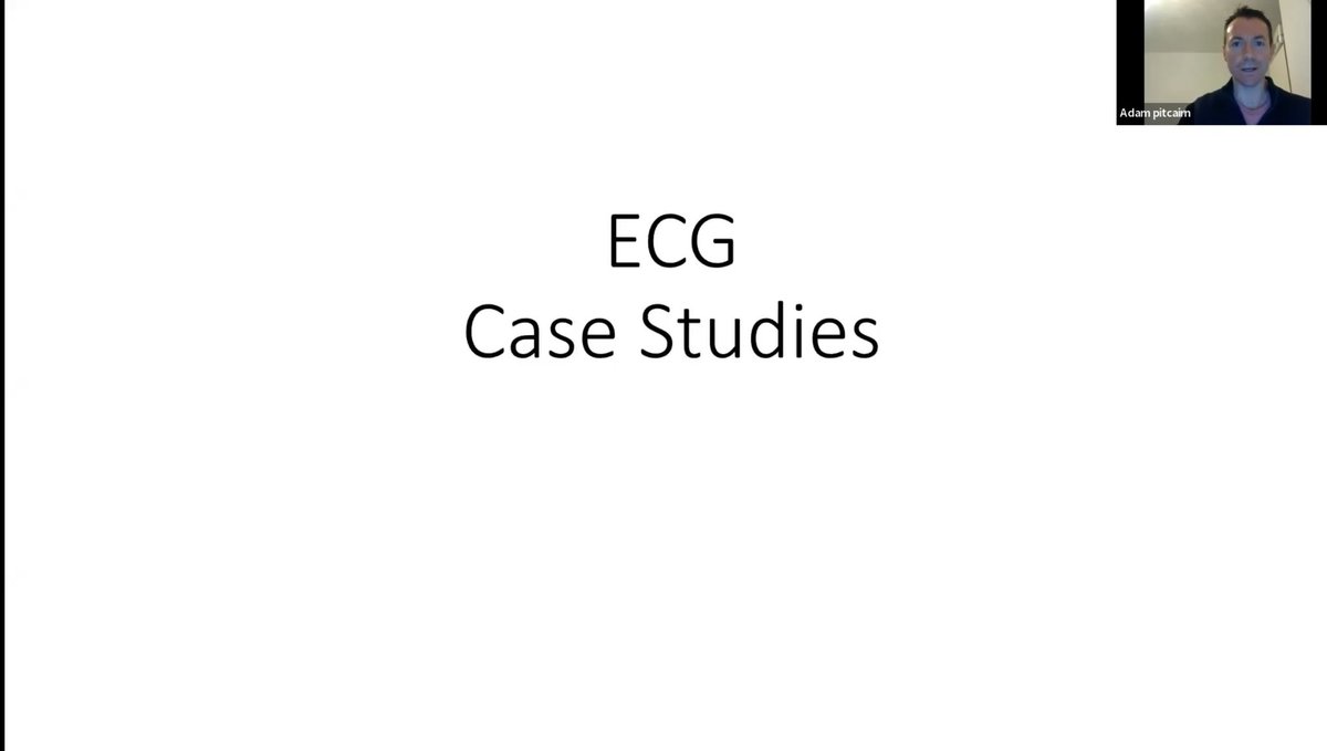All 3 lectures in the series from <a href="/EHAAT_/">ehaat_</a> CCP and #ECG expert  <a href="/AdamPitcairn/">Adam Pitcairn</a>. Part One vimeo.com/698193907/7c3d… Part Two vimeo.com/811971971/c87c… Part Three vimeo.com/766855163/074b…