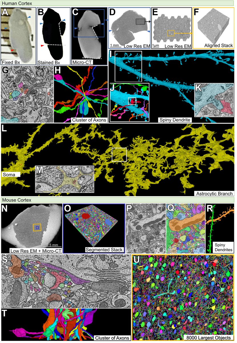 Synapse level circuit analysis in samples from psychiatric and neurological patients is now possible. Open access version of the paper went online today: authors.elsevier.com/c/1gq4F1S07qGpP.

#Neurosurgery,  #Connectomics, #Biopsies, #VolumeEM.