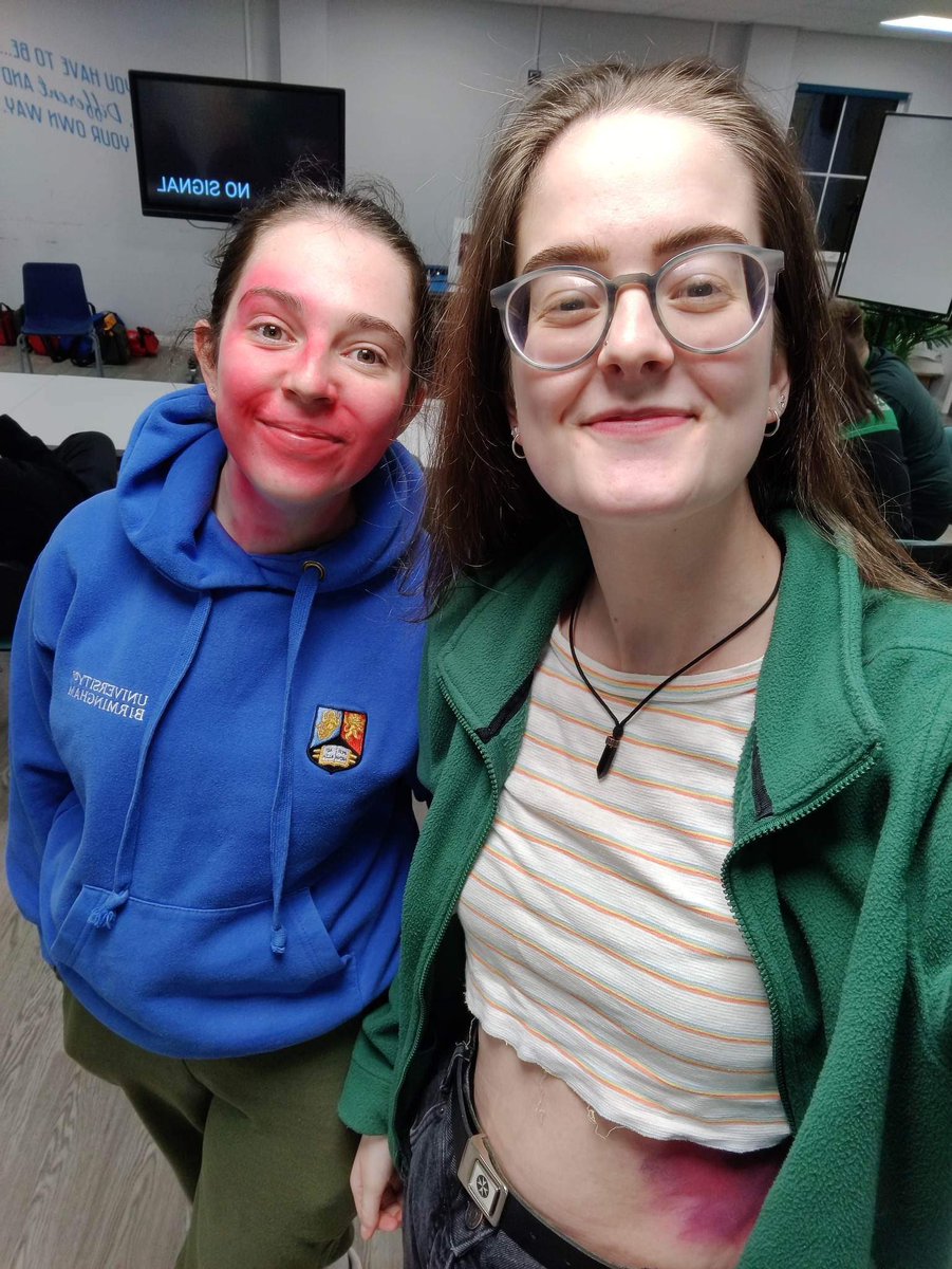 UoBFirstAid's tweet photo. This evening, Kirsty and Izzy went along to @SjaSolihull to support with their scenario evening! They were excellent casualties 💚

(Warning: fake vomit in last photo)

#AskMe #MySJADay #SJAStudents https://t.co/FiN820QfDF