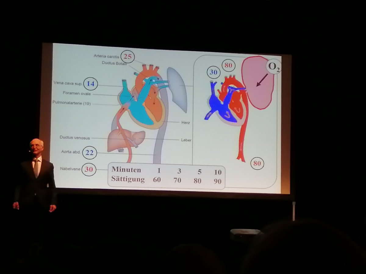 We had an honor to hear a good talk from Martin Jöhr, a brilliant, almost iconic peds advocate who inspired generations of peds anesthetists

📖#pedscard for dummies

 🔑 Understand the fetal circulation
🔑 Be patient and give time to a newborn (SpO2 90% is normal after 10min (!)