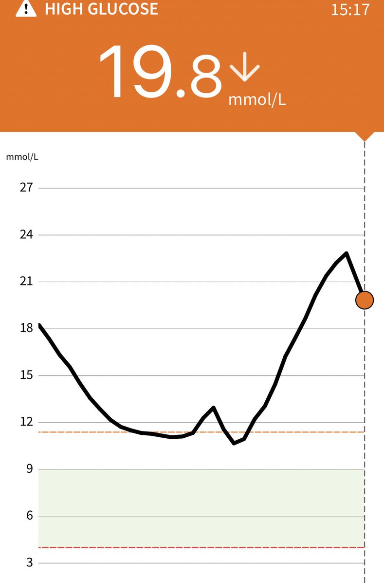 FfionHD's tweet photo. Oh the relief when you see the downward arrow. #simple #diabetes #t1d #libre #diabetestech https://t.co/lMyHBtXI28