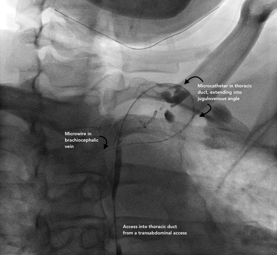 Steven Morales-Rivera, MD tweet media