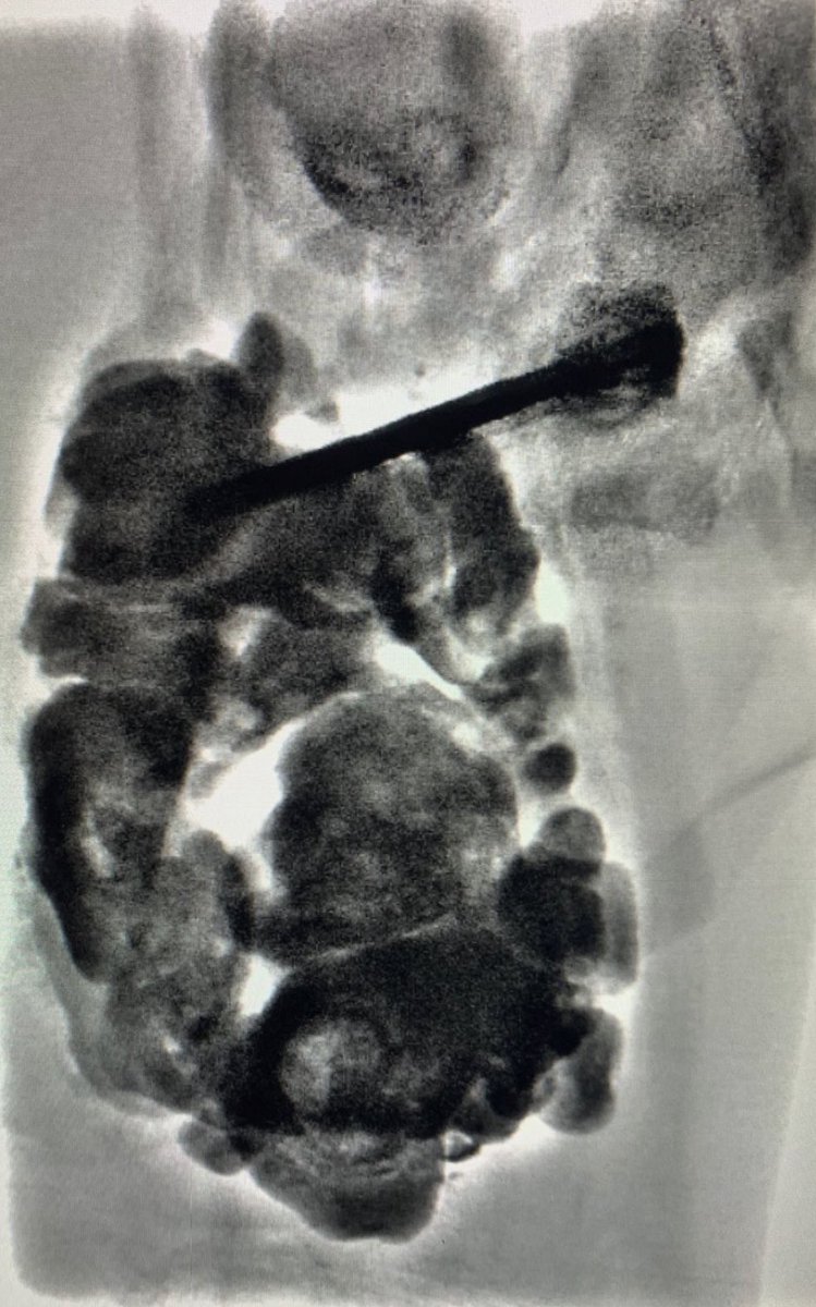 Dr. Dario Teplisky tweet media