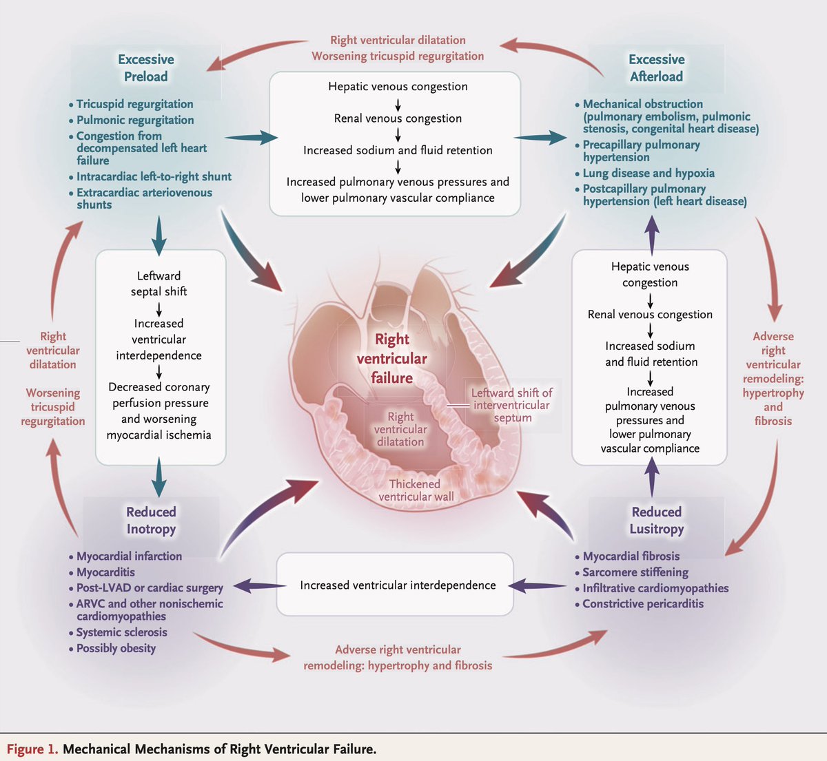 Here are the top 10 learning points from the elegant review of right ventricle failure by: @RyanTedfordMD, Evan Brittain and @Brian_Houston12: