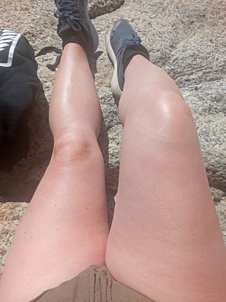Scarlett_VFL's tweet photo. @SpikeperezG Mis piernas https://t.co/da9ghP49Ut