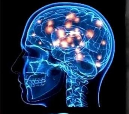 AnatomiaEl7499's tweet photo. El cerebro humano tiene 100 mil millones de neuronas, cada neurona conecta con otras 10 mil neuronas. sentado sobre sus hombros está  el objeto más complejo del mundo.
#datointeresantedeldia https://t.co/Oj3MVtclg2