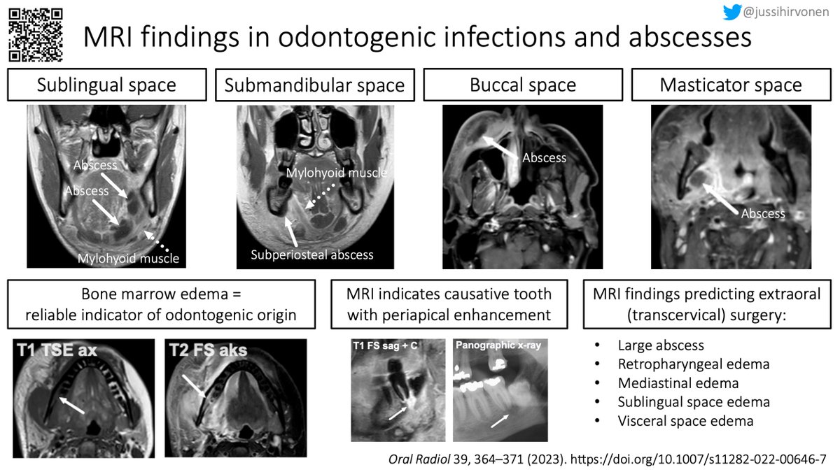 Jussi Hirvonen tweet media