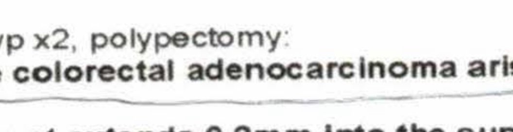 I don’t post a lot on this platform but if this helps one person, I will be glad. If you’re 45 or older, get screened for colon cancer. If I hadn’t, I would be still walking around with it instead of cured by the polypectomy done during the colonoscopy on 3/7. Please. Go do it.