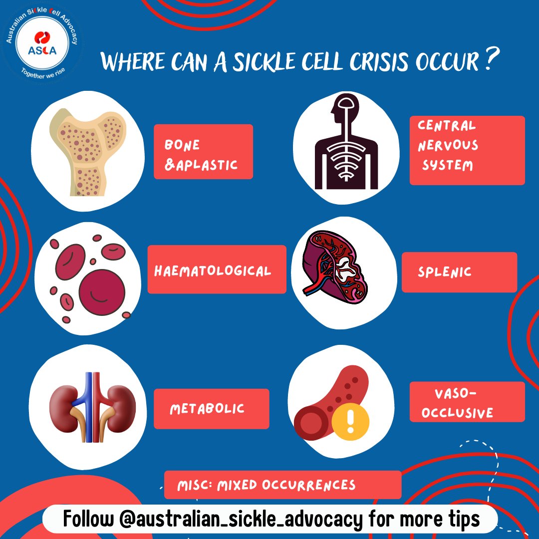 AuSickle's tweet photo. ๐ฏ Sickle cell crisis can be debilitating, but with โ
increased awareness and research ๐ฌ , we can work towards better treatment and management !!!
โก Know the facts, spread the word for Sickle Cell Disease. ๐ช
#TeamASCA #AustraianSickleCell #togetherwerise https://t.co/SUmf8WbvlB