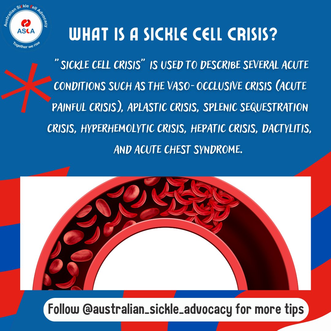 AuSickle's tweet photo. ๐ฏ Sickle cell crisis can be debilitating, but with โ
increased awareness and research ๐ฌ , we can work towards better treatment and management !!!
โก Know the facts, spread the word for Sickle Cell Disease. ๐ช
#TeamASCA #AustraianSickleCell #togetherwerise https://t.co/SUmf8WbvlB