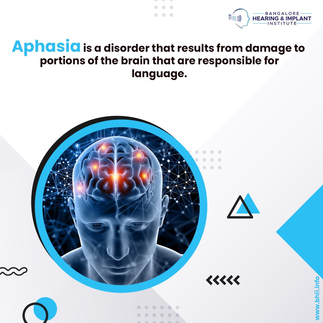 blrhii's tweet image. Did you know Aphasia could occur after a head injury or a stroke? Here&apos;s a quick peek into Aphasia. 
For hearing related problems or appointments, call: +91 63668 88883 

#aphasia #aphasiarecovery #aphasiatherapy #aphasiarehabilitation 
#bangalorehearingandimplantinstitute
