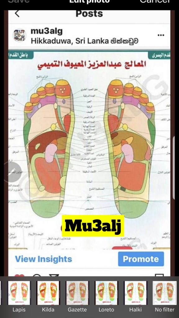 mu3alj's tweet photo. العلاج الانعكاسي أو ضغط وتدليك باطن القدمين أو كفين اليدين أو الأذنين هو مساعد فالعلاج التكميلي يتضمن تطبيق الضغط على نقاط محددة لتعزيز الشفاء والاسترخاء في أجزاء أخرى من الجسم
تستند هذه الممارسة إلى مبدأ أن هذه النقاط، والمعروفة أيضًا باسم الردود، تتوافق مع أعضاء وأنظمة مختلفة في الجسم
خلال جلسة العلاج الانعكاسي
يستخدم المعالج يديه أو أداة خشبية أو حديدية لتطبيق الضغط على نقاط الردود الانعكاسات فالقدمين واليدين والاذنين والتي تساعد بإذن الله في تحفيز عمليات الشفاء الطبيعية للجسم، وتحسين الدورة الدموية، وتقليل التوتر والالام فالجسم يستخدم العلاج الانعكاسي في العادة لعلاج مجموعة من الحالات، كثير جدا من الأمراض العضوية والنفسية بما في ذلك الألم المزمن ومشاكل الجهاز الهضمي والقولون والكبد والمرارة والصداع وأرق النوم و و و

على الرغم من أن العلاج الانعكاسي يعتبر عادة آمنًا
إلا أنه من المهم استشارة معالج مؤهل وإبلاغه بأي حالات صحية أو مخاوف قبل بدء العلاج