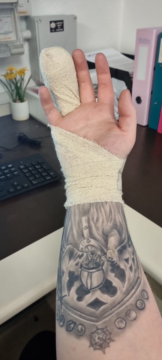 Montehllama's tweet photo. In hindsight. Coming to work the day after having an operation was probably a bad idea. I am in pain and am basically not allowed to do anything. Been sat at the computer filing shit. All because of one finger. 
 On the funny side the dressing is a beast. https://t.co/Eh8w3KP3wt