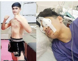 صدای #زانیار_تندرو باشیم، زمان کمک به اوست، این جوان یک چشمش را در جریان خیزش مردمی از دست داده، ناچار به ترک ایران شده و حالا در کمپ پناهجویان ترکیه وضع بدی دارد.
فعالان حقوق بشر و چهره های سرشناس مخالف جمهوری اسلامی باید برای نجات و درمان فوری او کاری انجام دهند.
#مهسا_امینی