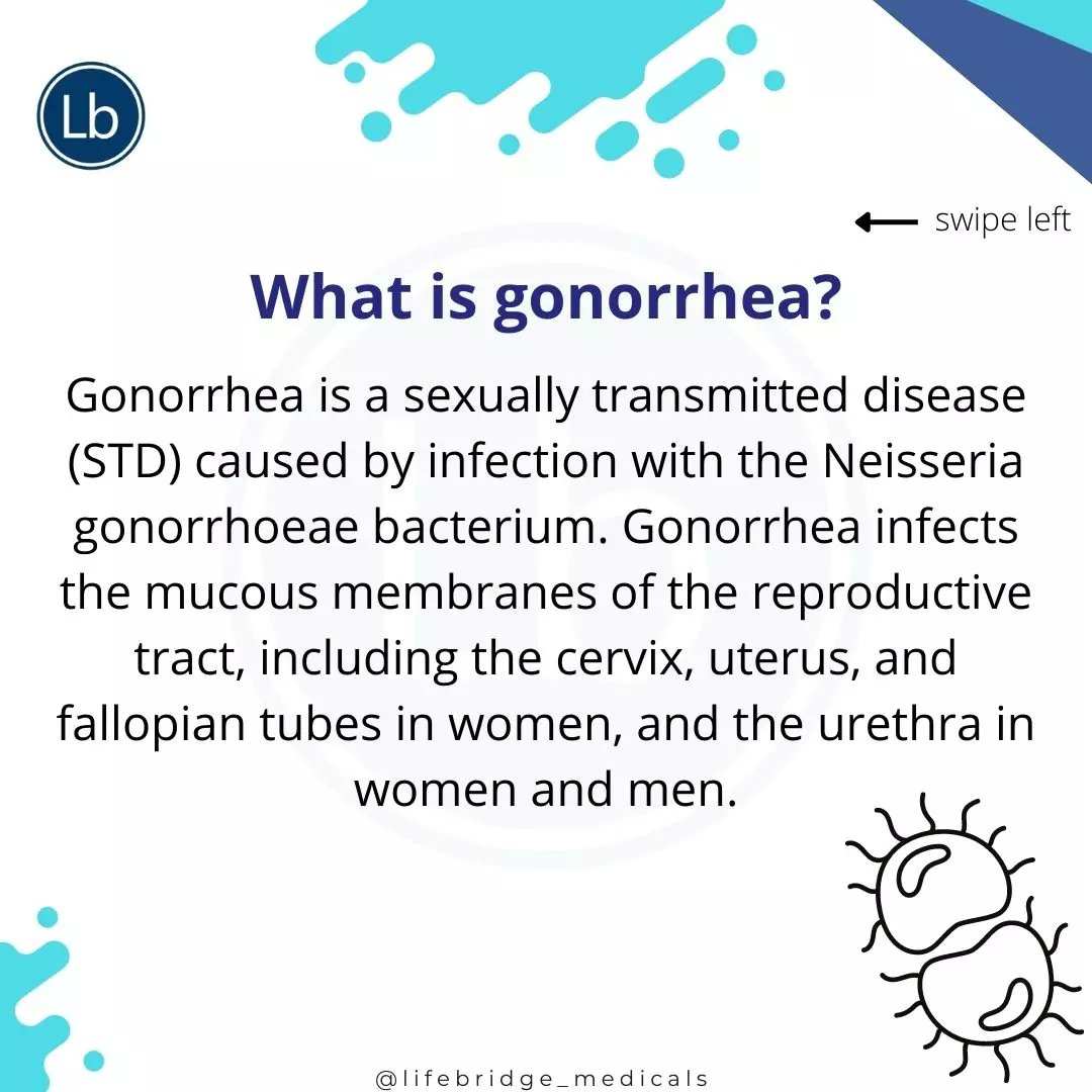 LifebridgeMDC's tweet photo. Gonorrhea is a sexually transmitted bacterial infection that, if untreated, may cause infertility.
Regular screening can help detect instances when an infection is present despite having no symptoms.
#lifebridgemedicals #cancer #hiv #hepatitis #vdrl #gonorrhea  #lifebridge https://t.co/lSLS3dnf7D