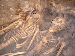 #onthisday 29th March 1461 Battle of Towton.
In 1996 at Towton Hall in Yorkshire a mass grave containing the remains of approximately 50 individuals discovered.  
All males who had suffered extensive wounds inflicted by medieval weapons.
28,000 dead cited for this battle.