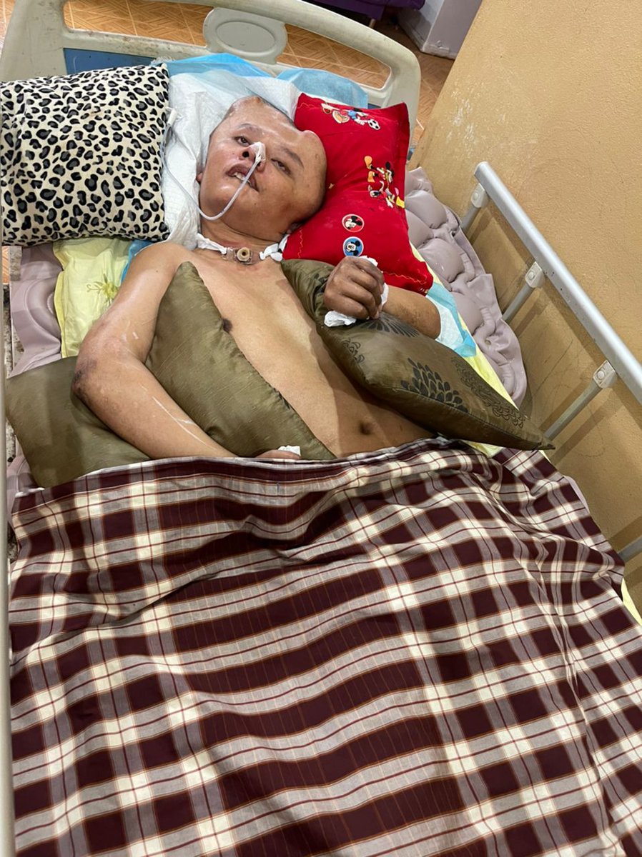 MarhaenMy's tweet photo. 3 tahun suami terlantar koma dekat rumah lepas terbabit dengan accident mengakibatkan:

1. Tempurung kepala terpaksa dibuang
2. Patah tengkuk &amp; dua pergelangan tangan

Sampai sekarang isteri still berharap suami dapat sembuh balik. Tulun guys🙏 https://t.co/Zu5k6ATWCD