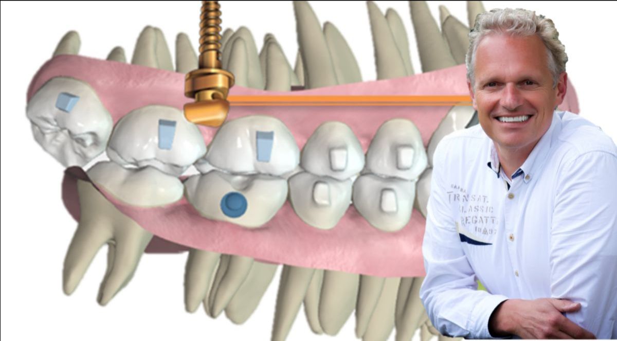 IntegratedOrtho's tweet photo. Spark online toegang - https://t.co/tKbx4ikyTi https://t.co/v7jfJI61tA