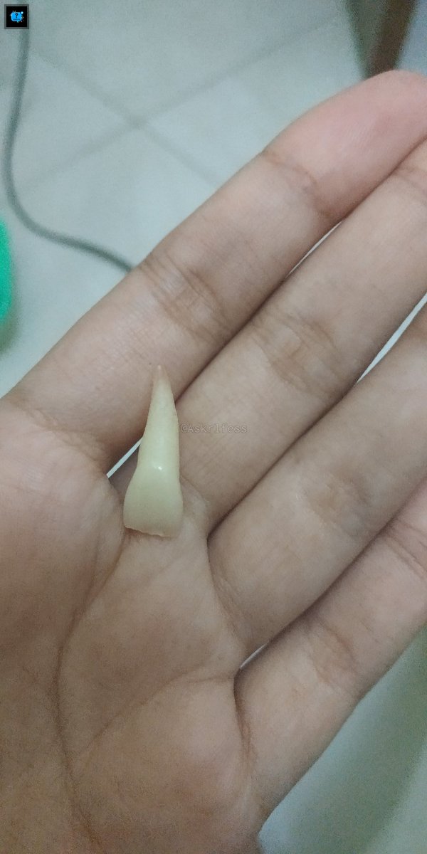 Askrlfess's tweet photo. Gais gigi aku copot gara2 jatoh, nambal di puskesmas tata caranya gimana ya? Terus kisarannya berapa? Makasih yg udh jawab [askrl] https://t.co/NN4vhvg0Id