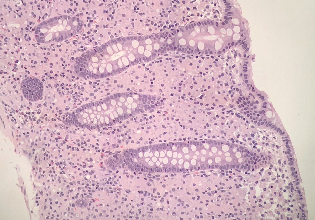 Austin McHenry, MD tweet media