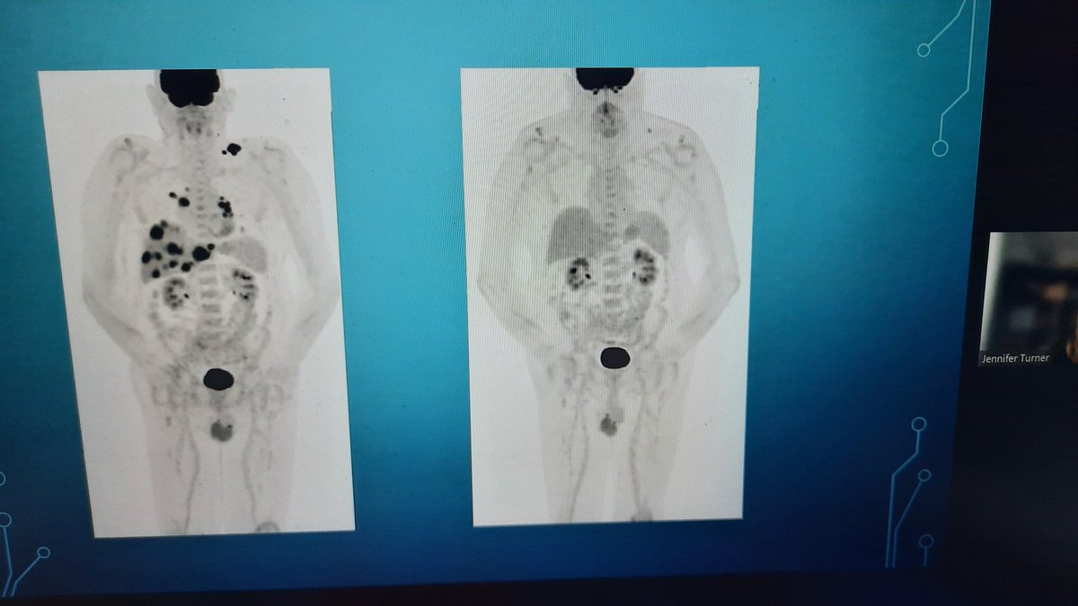 Fascinating webinar tonight looking at the use and impact of immunotherapy with Dr Jennifer Turner. Amazing to learn more about its benefits and its challenges.#EducatingForExcellence
