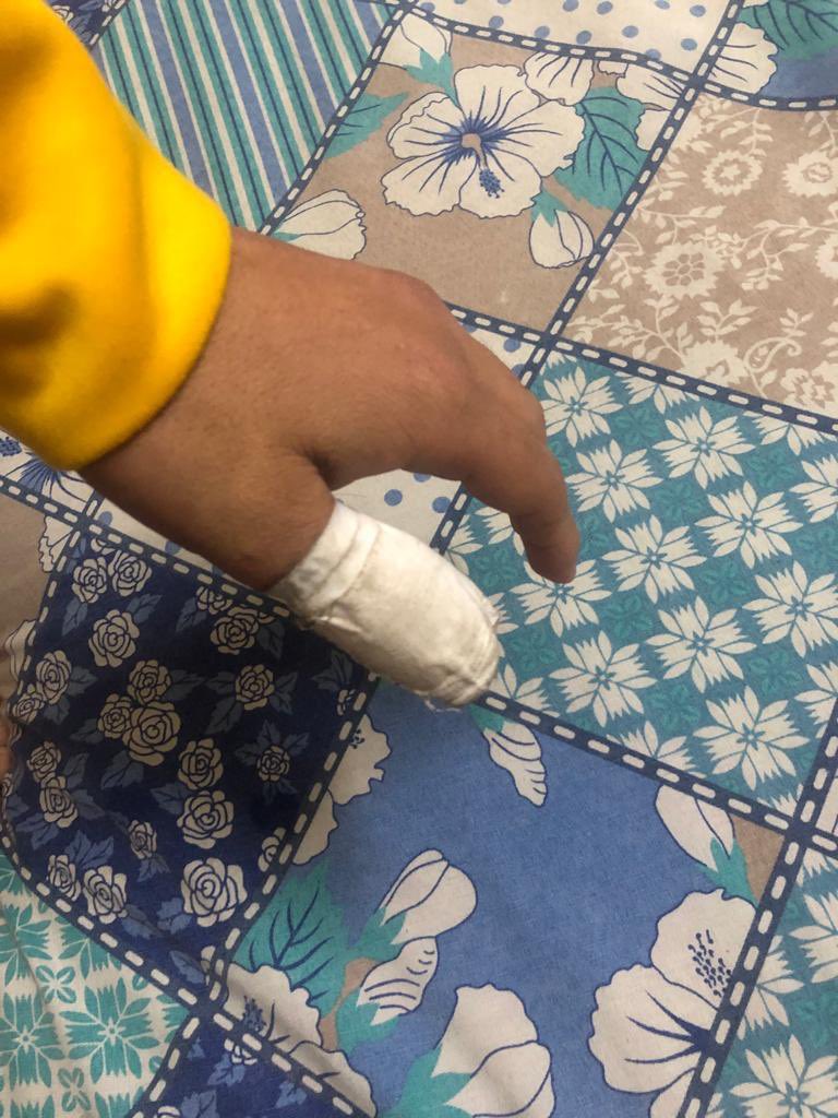 Amjad_ISF's tweet photo. Zainul Hassan an IR student from numl university an ISF member. He was arrested from Islamabad during IK’s appearance in JC. He is badly tortured. His thumb is fractured. He is out now and is saying that I will fight with more passion now. U v lost this battle. Try smthing else https://t.co/IMWUwctWxn