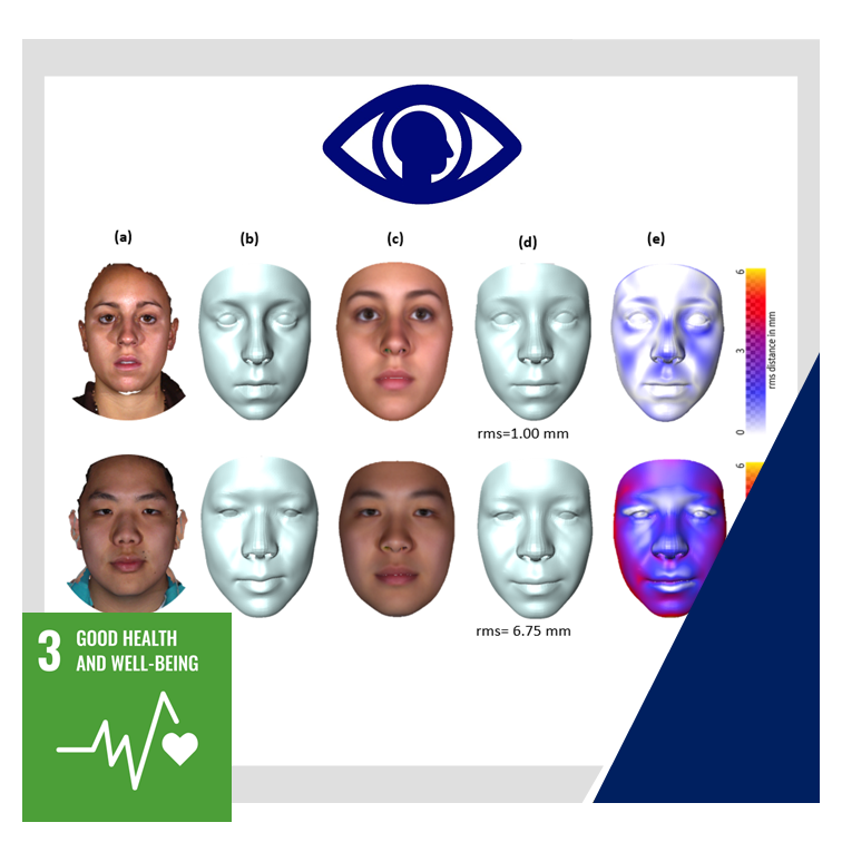 SAJS_Official's tweet photo. ‘@VisionBernie @FelixA256 et al. offer a cost-effective and easily accessible #imaging tool for Foetal Alcohol Syndrome screening using 2D images for facial #3Dreconstruction. #FAS #SDG3 https://t.co/trQ9Z58w3K https://t.co/8Q2xLXVteR