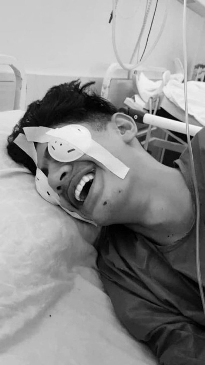 Sonofthebeach22's tweet image. #زانیار_تندرو  نوجوان ۱۷ ساله پیرانشهری که در جریان  خیزش انقلابی مردم ایران بر اثر شلیک مزدوران جمهوری اسلامی، بینایی چشم راست خود را از دست داده بود، توسط پلیس یونان به   ترکیه تحویل داده شده و در خطر دیپورت است. 
 #HelpHim