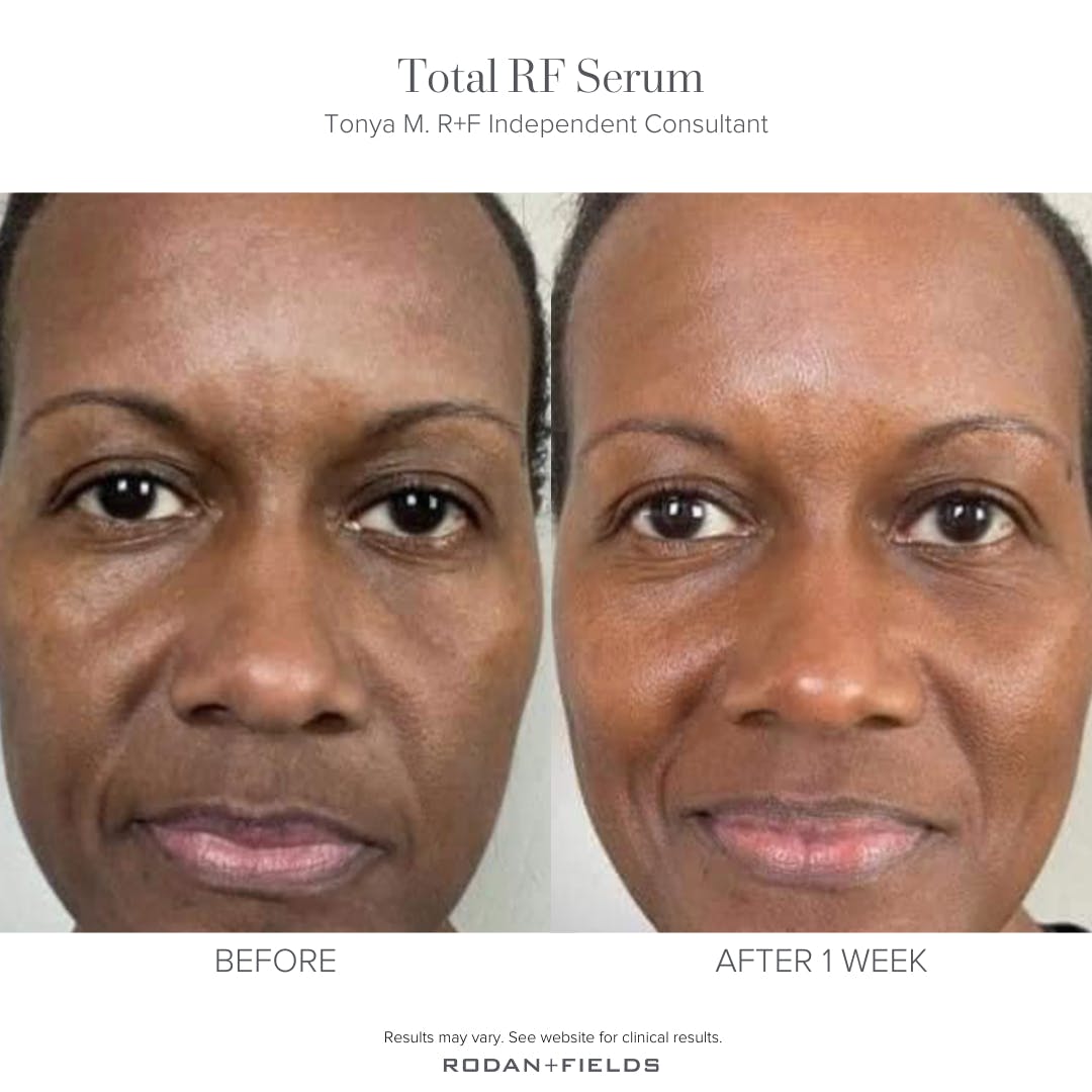 decordeyewear's tweet photo. Our most comprehensive anti-aging serum features RF TriEnergy Complex that energizes millions of surface skin cells by 200% to address all key signs of skin aging. #skincare #lashes #beauty #health #enlighteningeyes https://t.co/Pni4SCh5sT https://t.co/hp3jJi8IcD