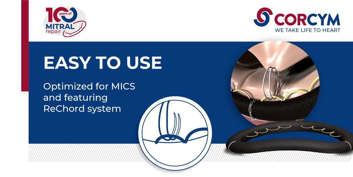 CORCYM_OFFICIAL's tweet photo. #Memo4D features the ReChord System, a chordal sizing system that aims to standardize neochordae implantation without the need for physical measurement. This system offers a reproducible technique while accelerating procedure times.
For HCP only.
#Corcym #MitralRepair https://t.co/L0kmgIvDbi
