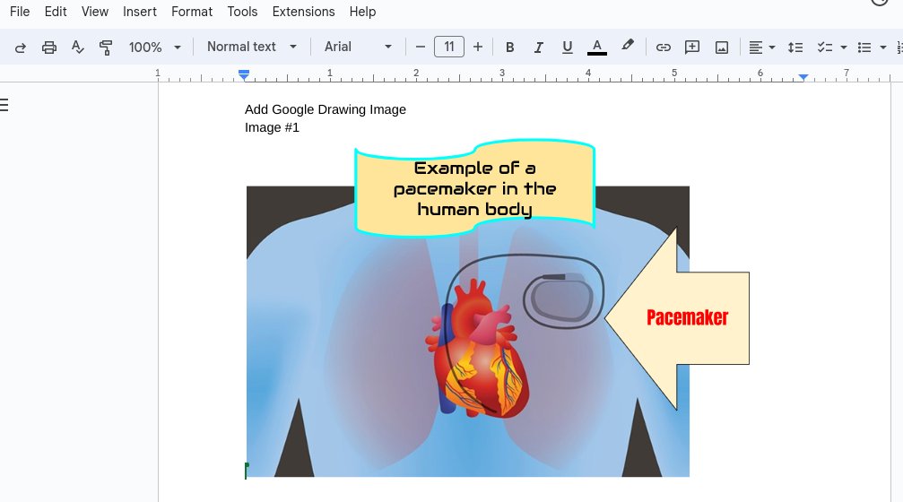 lovelandtech's tweet image. Another great example of inserting a #GoogleDrawing into #GoogleDocs.