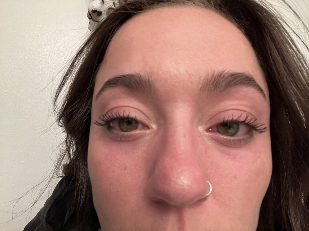 abicakes_'s tweet photo. You ever cry so hard for so long you need to put ice packs on your eyes? https://t.co/xlIybkRbN3