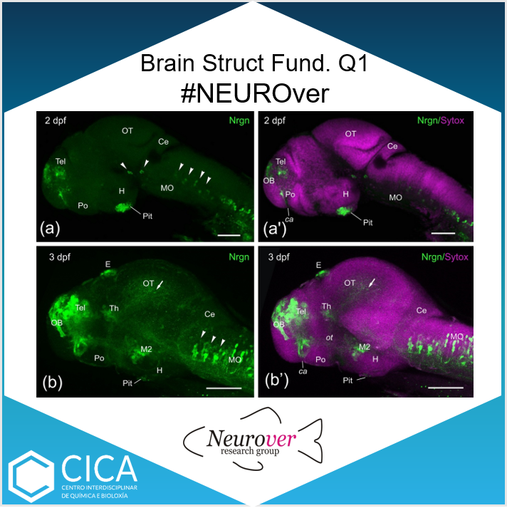 CICAUDC's tweet photo. Anabel Alba-González, Julián Yáñez, Ramón Anadón, Mónica Folgueira from #NEUROVER @MonicaFolg @Anabel_Alba5 published “Neurogranin-like immunoreactivity in the zebrafish brain during development” in Brain Structure and Functions. 👉 https://t.co/5SVclyqNAN https://t.co/kBky8gRi5Q