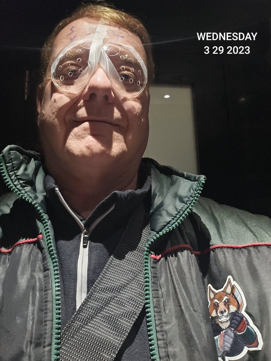 rod7416's tweet image. Lens replacement surgery. Both eyes.  ALREADY amazing difference @OpticalExpress #Glasgow #lensreplacement #eyesurgery