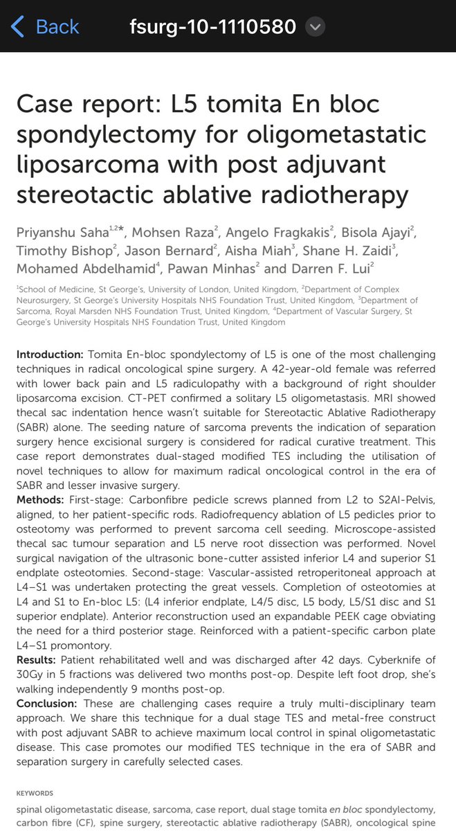 SpineResearchSG's tweet photo. New published case report on spinal oligometastatic disease and the utilisation of novel techniques for a dual staged modified tomita en-bloc with post adjuvant SABR 
#SpinalMets #SpinalSurgery #TomitaEnblocSpondylectomy #StereotacticAblativeRadiotherapy #CarbonFibre #SABR https://t.co/61kti2PyxK