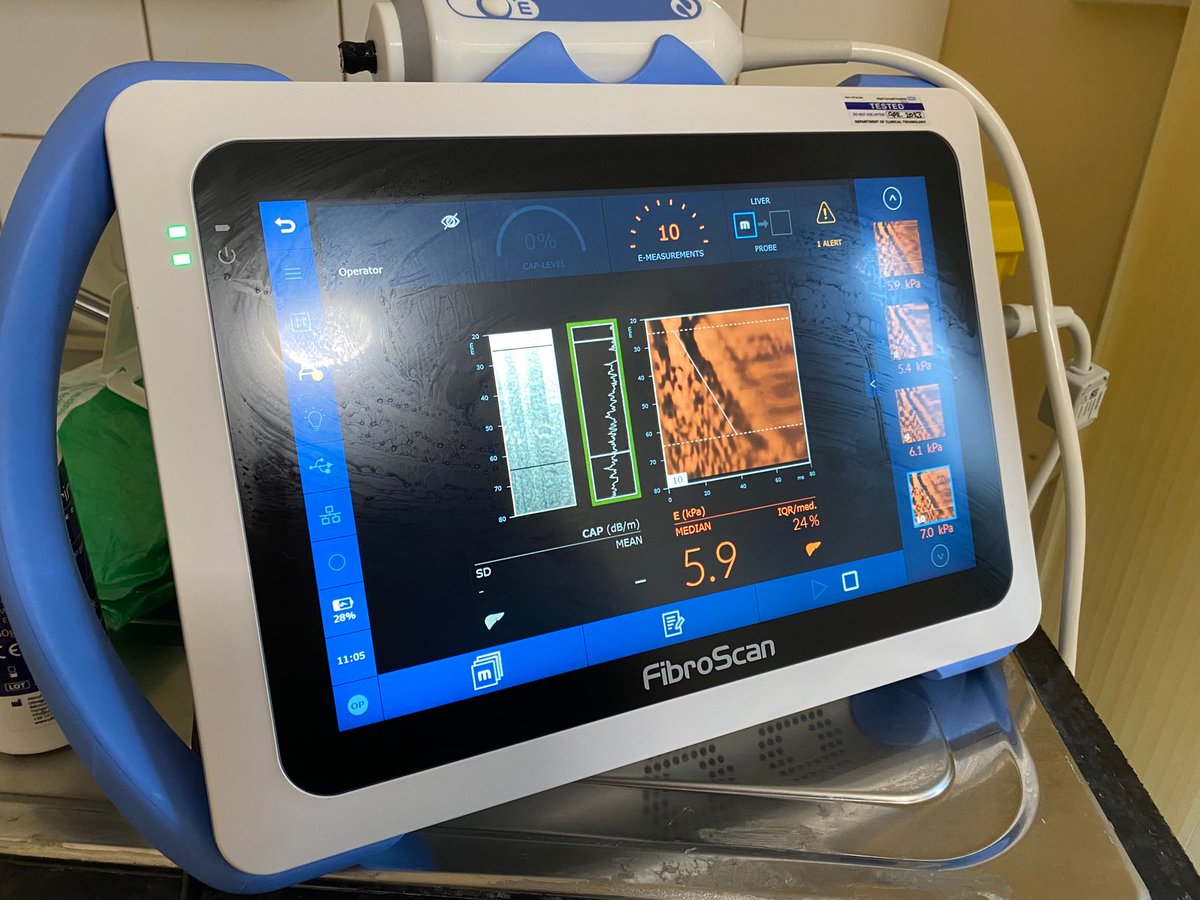 We've had specialist nurses from <a href="/RCHTWeCare/">Royal Cornwall Hospitals NHS Trust</a> visit Harbour today for our health check day 🧑‍⚕️ They've been offering liver scans that are quick, non-invasive and give fast results. Looking after your liver is so important, and we're very grateful to have this service visit today ⬇️