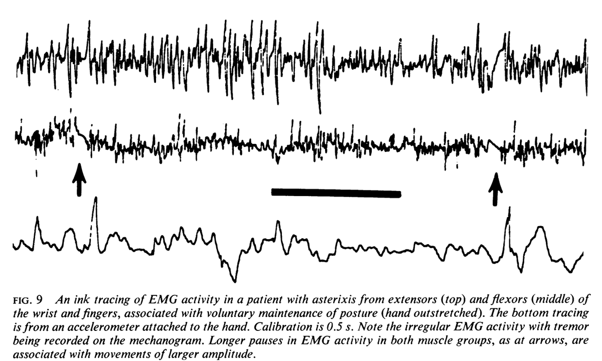 CwruEpilepsy tweet picture