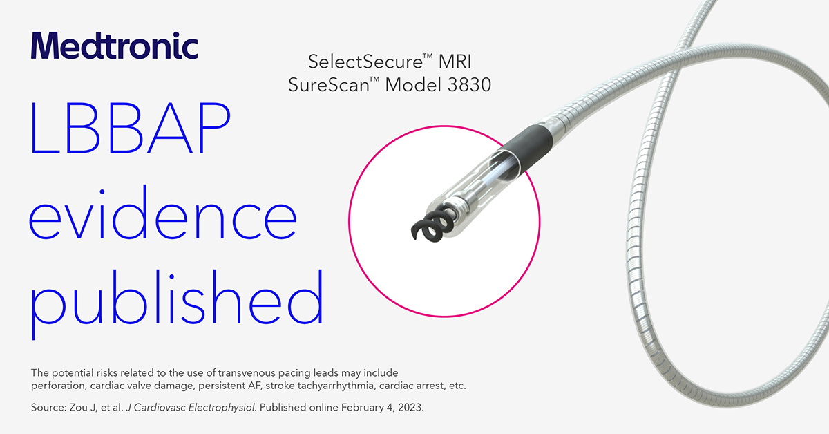 CT imaging from the 3830 LBBAP Modeled Reliability Study, and 3830 fatigue testing, project 99.98% intracardiac fracture-free rate in the LBBA at 10 years, which is similar to RV pacing leads. Read more:
bit.ly/3KDIYFi 

Important safety info: bit.ly/3UfgWDs