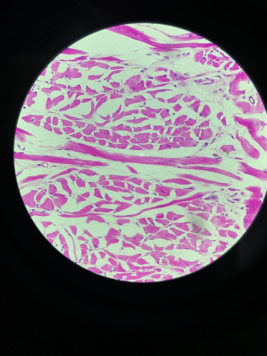 imraynan's tweet photo. fotos de algumas lâminas de histologia - uma disciplina que estou tendo esse semestre. 🔬
#collgetwt https://t.co/ISVlk1HE9k
