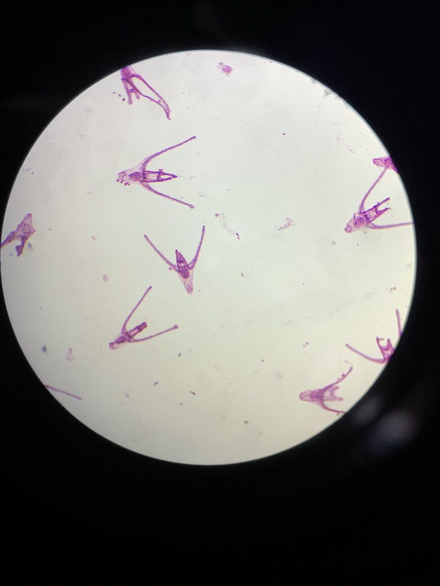 imraynan's tweet photo. fotos de algumas lâminas de histologia - uma disciplina que estou tendo esse semestre. 🔬
#collgetwt https://t.co/ISVlk1HE9k