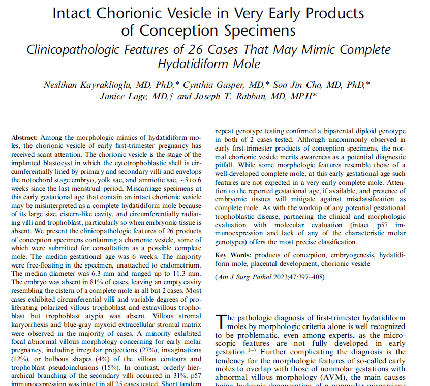 slusagar's tweet photo. blinded by hx, I think complete mole is in🔬DDx
(although at 7 weeks highly unlikely to see CM👀like this)

👉🏽this was hydropic abortus (what's shown is chorionic vesicle);  genotype studies came back non-molar

✔️great recent study by @joerabban PMID: 36729386 (table is💰) https://t.co/ZbOAzY62T1